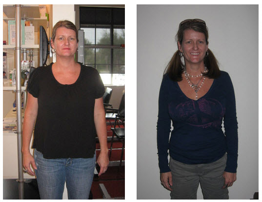 Chiropractic Jupiter FL Before and After Stephanie